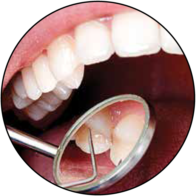 4.5x-classic-expanded-field-dental-2.png